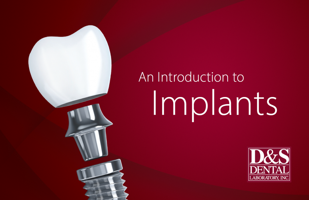 Download Implant Booklet D&S Dental Laboratory Send a Case to Our